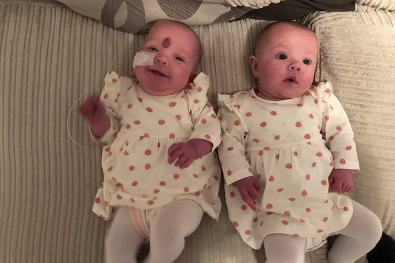 Doctors Told Mom to Kill a Disabled Twin in an Abortion, She Refused and Her Daughter is Improving After Surgery