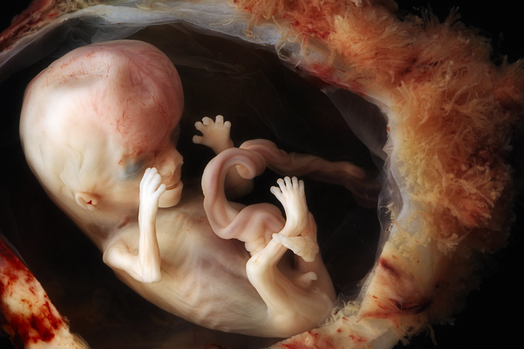 Pro-Life Members of Congress Say Human Beings Killed in IVF Need Protected Too