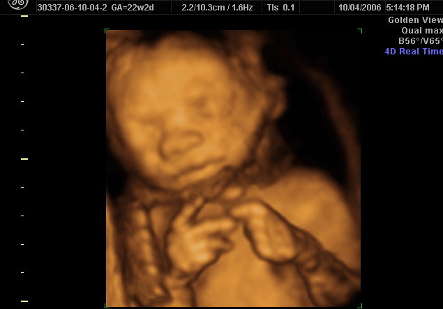 South Dakota Amendment Would Make Killing Babies in Abortions a “Right” Up to Birth