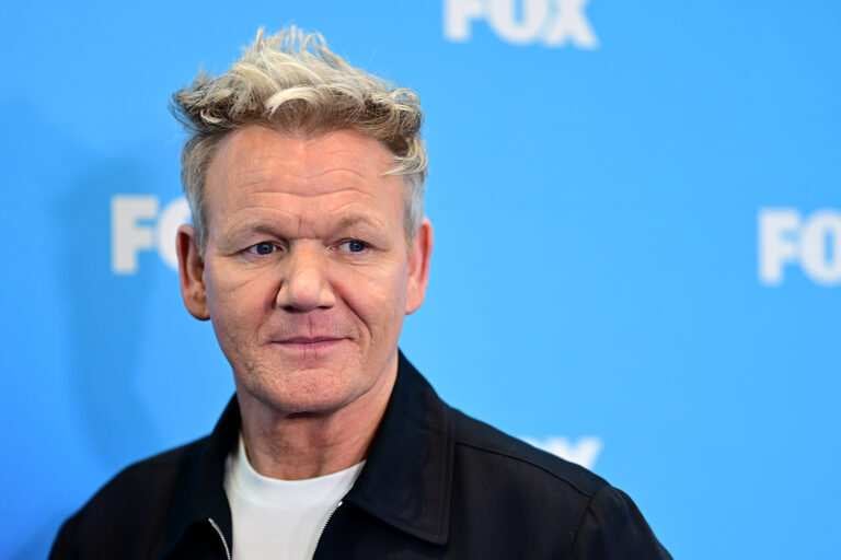 Gordon Ramsay, showing off bruised torso, says he’s ‘lucky to be here’ after bike crash
