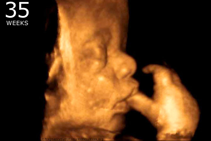 Aborted Babies are Being Flushed Into America’s Drinking Water