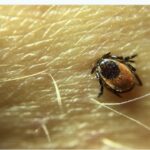 ERs Across US Report Near-Record Level Of Tick Bites This Summer