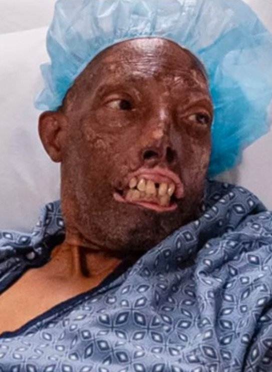 He Refused a New Face That Didn’t Look Like Him — And Waited Until the Right One Changed His Life Forever