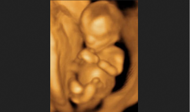 Texas House Committee Advances Major Pro-Life Bill to Stop Deadly Abortion Pills