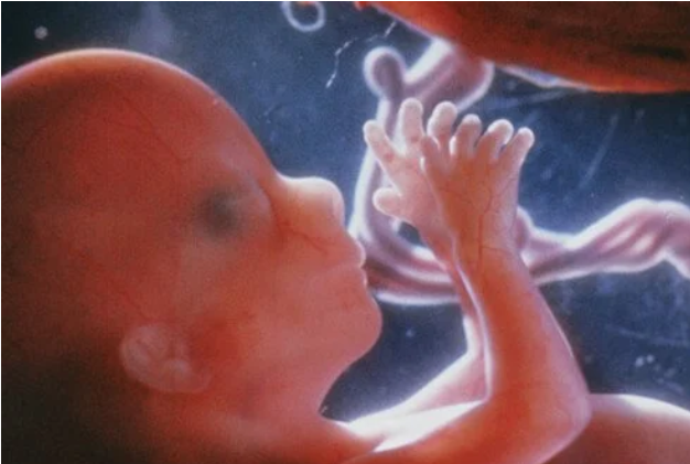 Texas and Florida are Fighting to Stop the Abortion Pill