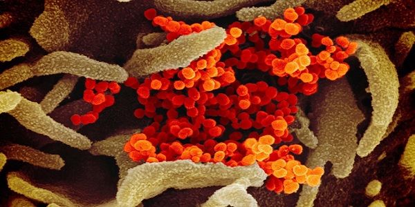NIH schemes to keep risky gain-of-function research alive despite Trump crackdown